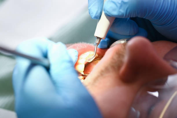 Best Emergency Denture Repair in Pine Mountain, GA